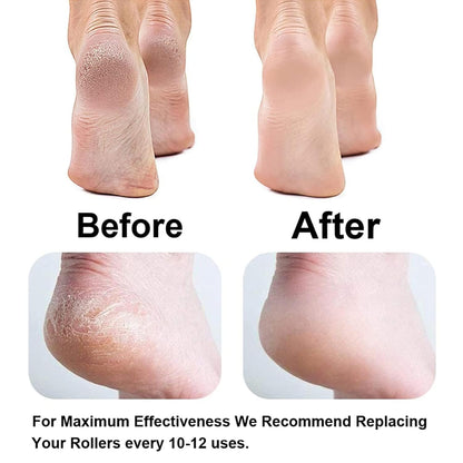 Electric Pedicure Foot File Callus Remov...